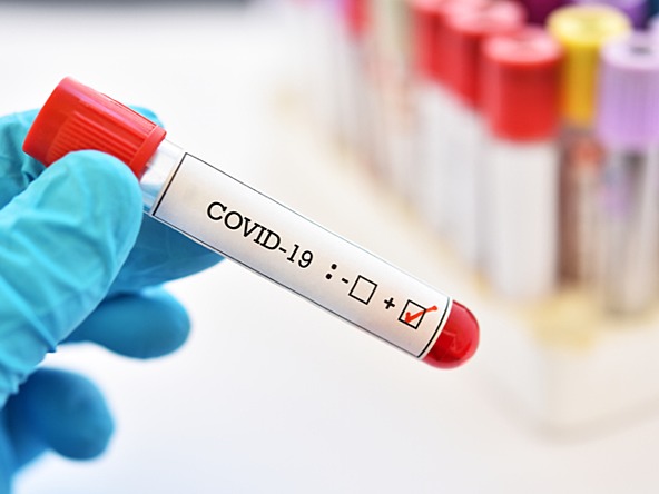 Covid testing coronavirus_crop